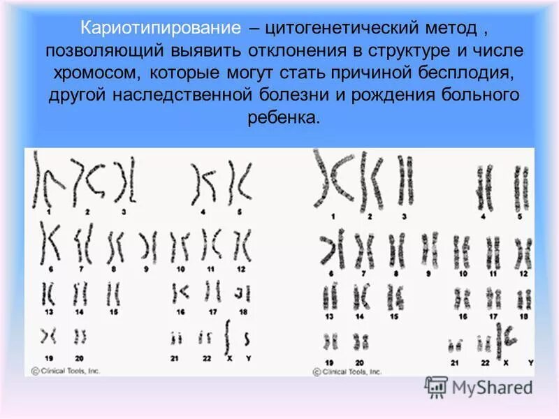 Цитогенетический метод изучения кариотипа. С помощью цитогенетического метода. С помощью цитогенетического метода. Виды цитогенетического метода. Молекулярно-цитогенетический метод.