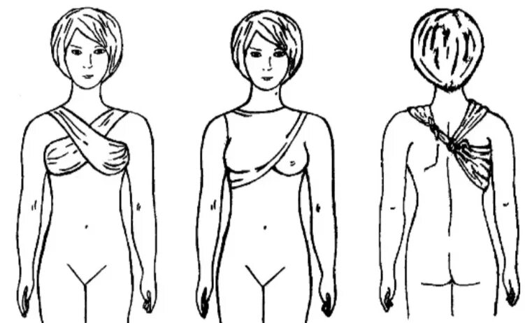 Повязка на молочные железы алгоритм. Косыночная повязка на молочную железу. Косыночная повязка на молочную железу алгоритм. Наложение косыночной повязки на молочную железу. Косыночная повязка на 2 молочную железу.