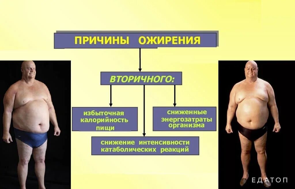 Зеркальная болезнь это