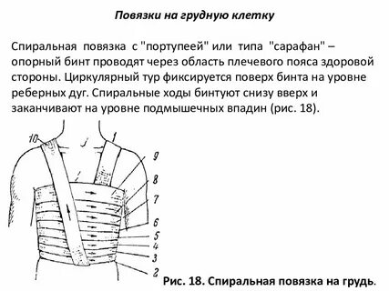 Повязка на ребра