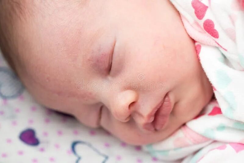А у вас есть "поцелуй аиста"?:) - 30 ответов форум Babyblog