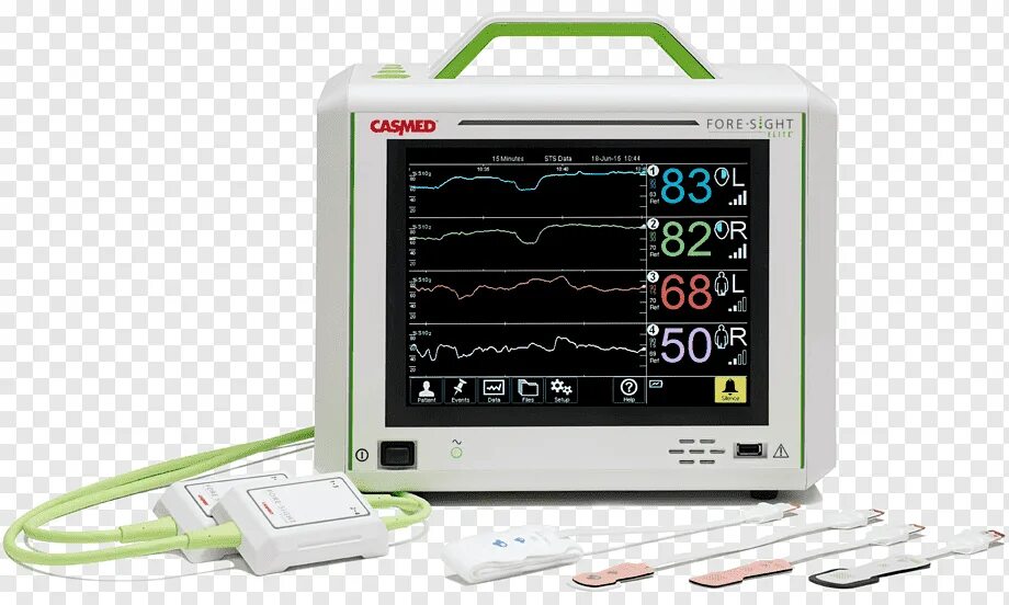 Прибор монитор. Компьютерная мониторинговая пульсоксиметрия. Пульсоксиметр реанимационный. Пульсоксиметр с монитором. Пульсоксиметры медицинские.