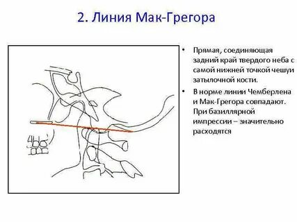 Точка рт