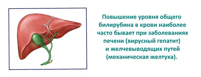 Повысилось в крови печени. Билирубин и желчный пузырь. Повышенный билирубин желчный пузырь. При повышенном билирубине. Кровь повышения билирубина печени.