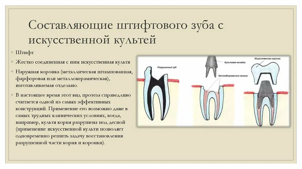 Какую функцию выполняет коронка зуба. Культевая Штифтовая коронка. Восстановление культи со штифтом. Искусственная культя со штифтом.