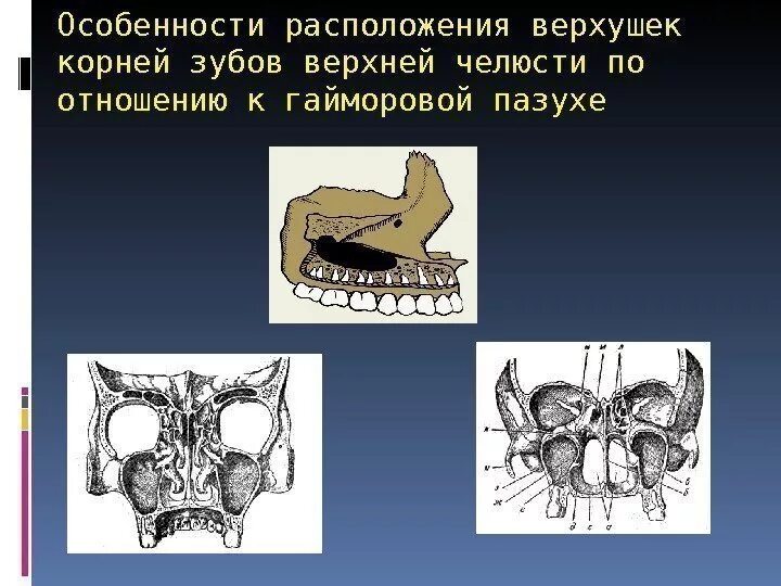 Располагающихся на верхушке