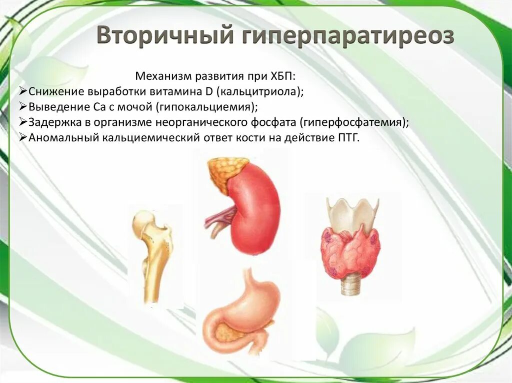 Лечение гиперпаратиреоза у женщин. Вторичный гиперпаратиреоз. Первичный гиперпаратиреоз. Клинические проявления гиперпаратиреоза. Третичный гиперпаратиреоз.