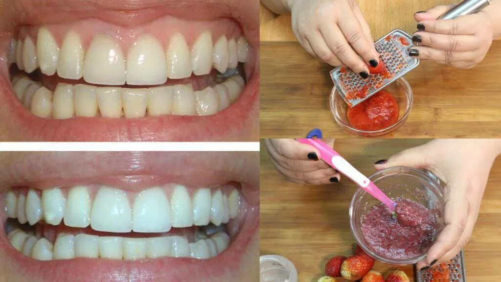 Можно ли есть зубы. Отбеливание зубов в домашнихусловтях. Отбеливание зубов в домашних условиях. Как отбелить зубы в домашних условиях. Отбеливание зубов домашнее отбеливание.