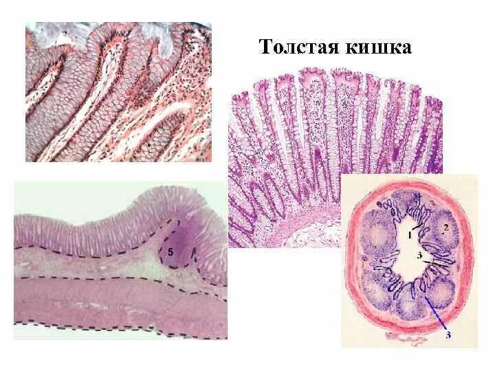 Слизистая оболочка толстой кишки. Толстый кишечник слизистая оболочка. Толстая кишка слизистая оболочка. Меланоз слизистой толстой кишки. Слизистая оболочка 12 кишки