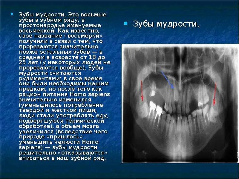 Восьмерки зубы удаленного.