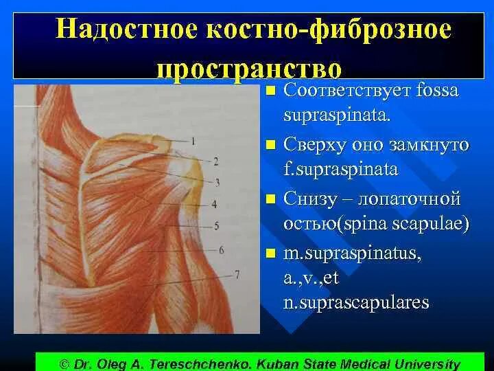 Операции верхних конечностей. Надостное пространство. Костно фиброзные ложа лопатки. Надостное костно фиброзное ложе лопатки. Надостное костно фиброзное пространство.