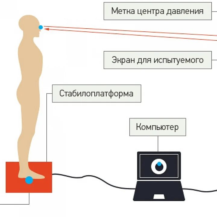 Биологическая Обратная связь схема. Методика биологической обратной связи. Бос аппарат биологически обратной связи. Стабилоплатформа.