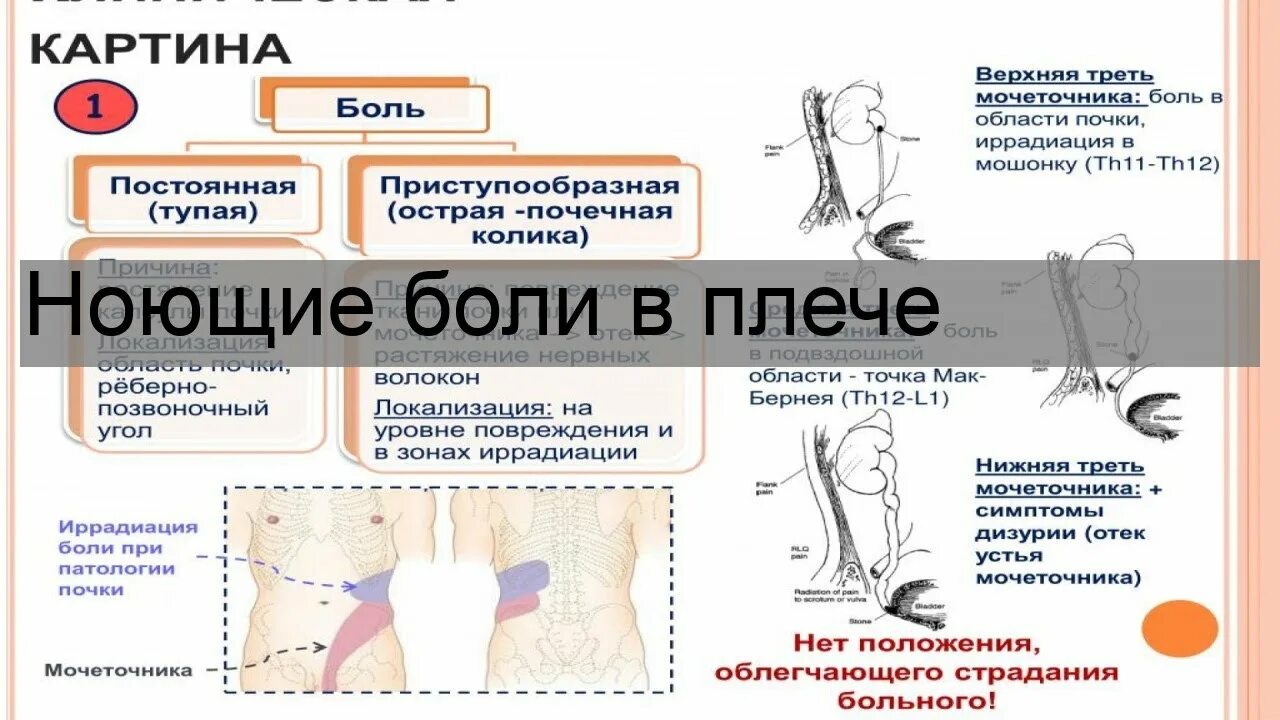 Слабая ноющая боль. Боль в плече постоянная ноющая. Ноющая боль в Плесе. Ноющая боль в левом плече.