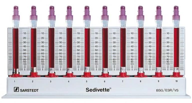 Соэ метод вестергрена. Прибор Панченкова СОЭ. Штатив для СОЭ по Вестергрену. СОЭ метод Панченкова норма. Пробирки Вестергрену для СОЭ.