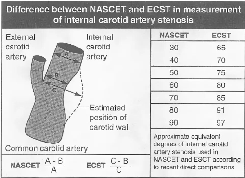 Стеноз по формулам nascet. Стеноз сонной артерии по nascet. Степень стеноза сонных артерий по ecst. Измерение стеноза по nascet. Методы измерения стеноза сонной артерии.