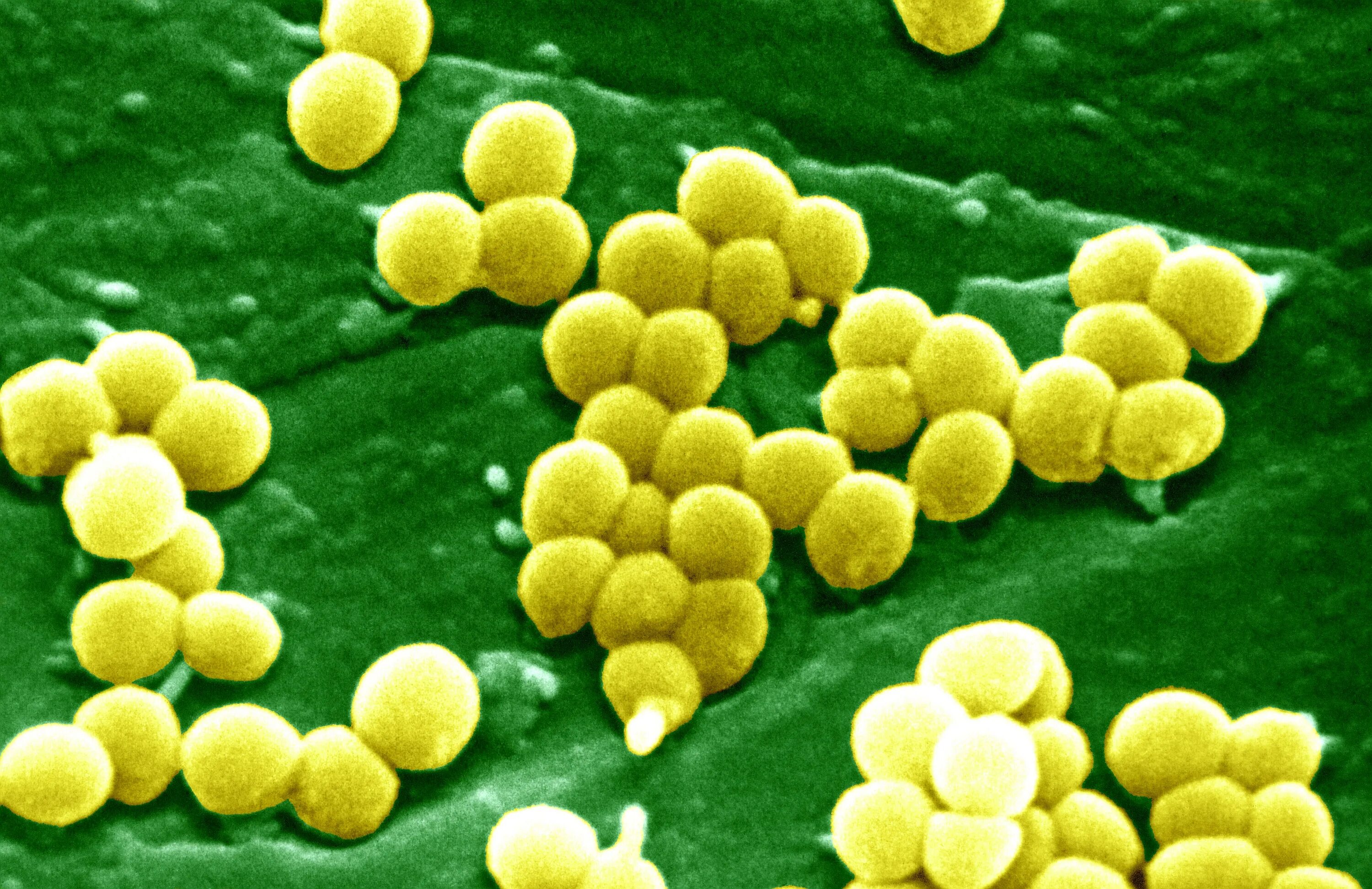 S. aureus золотистый стафилококк. Стафилококк золотистый у новорожденных. Метициллин-резистентный золотистый стафилококк. Золотой стафилококк под микроскопом. Staphylococcus aureus 4
