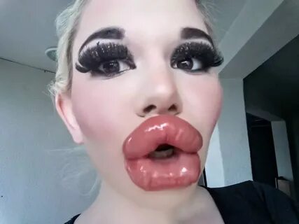 Andrea Ivanova, 22, from Sofia, Bulgaria claims to have the biggest lips in...