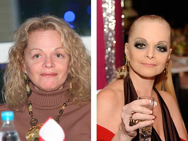 лариса долина сейчас 2021. лариса долина сейчас. что у долиной с левым глазом. лариса долина без макияжа. лариса долина 2005.