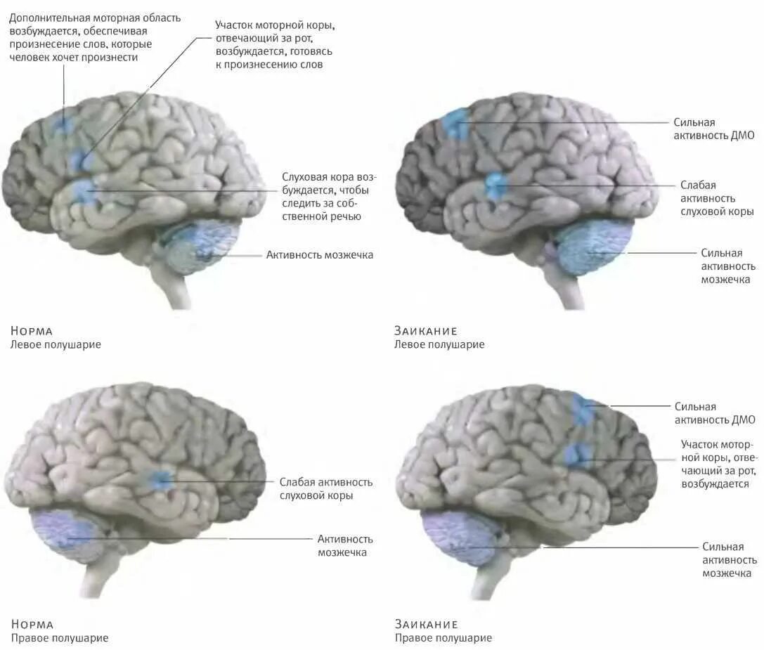 Как работает мозг книга. Речевые зоны мозга. Дополнительная моторная область мозга. Заикание мозг. Заикание зоны мозга.