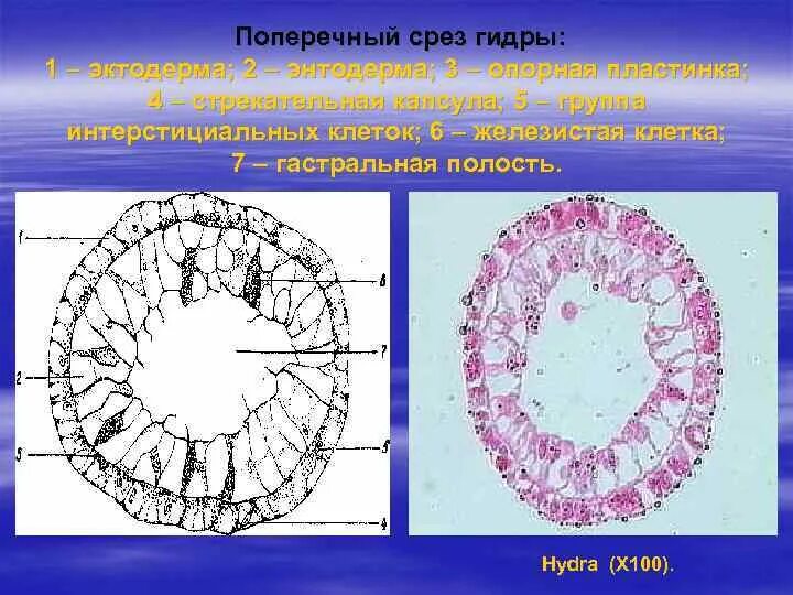 Группа срез. Продольный срез гидры. Поперечный срез гидры под микроскопом. Строение гидры продольный срез. Поперечный разрез гидры.