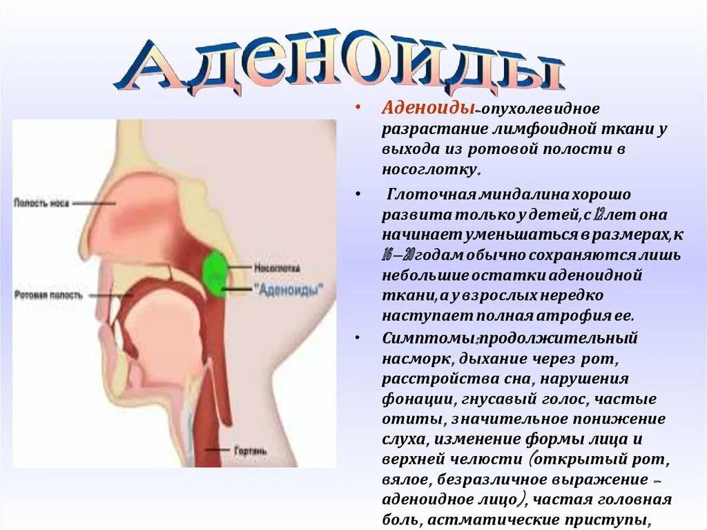 Аденоидные вегетации 1. Носоглотка воспаление аденоиды. Аденоиды 1 степени у детей первые симптомы. Аденоиды носоглотки 2 стадия. Строение носоглотки аденоиды.