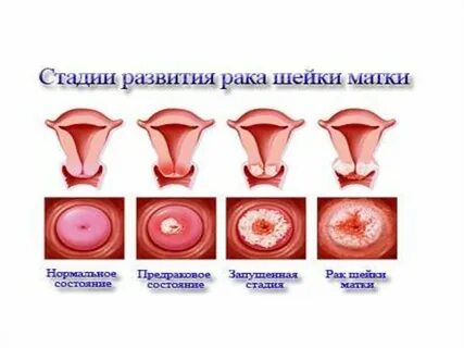Тарихи эротика көркем фильмдері