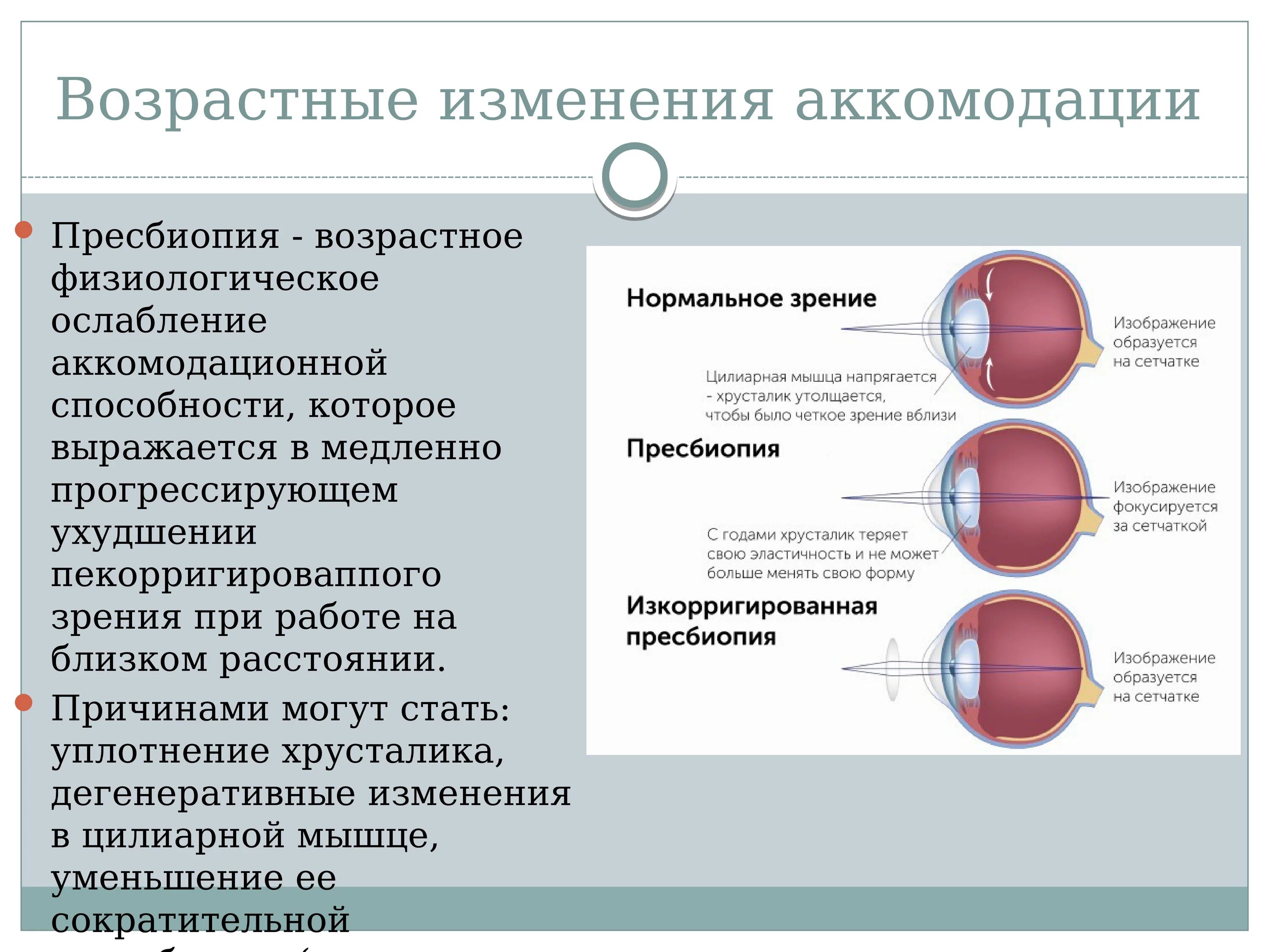 Аккомодация у взрослых. Возрастные изменения аккомодации глаза. Аккомодация. Изменение аккомодации с возрастом.. Возрастные изменения рефракции и аккомодации. Пресбиопия возрастные изменения аккомодации.