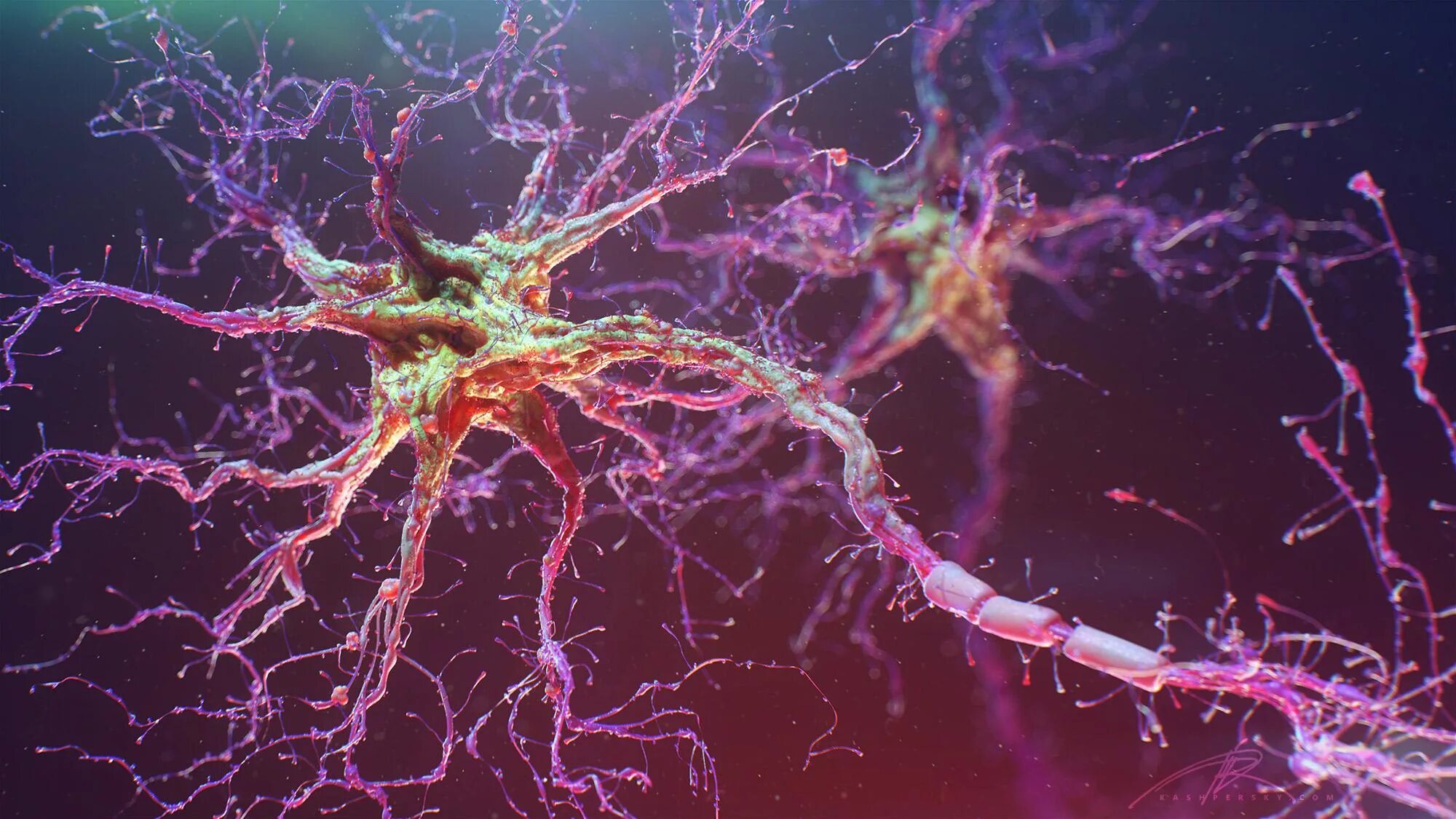 Ужасно нервная. Нейрон гистология. Нейрон клетка головного мозга. Нервная система человека Нейрон. Разрушение нервных клеток.
