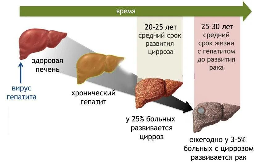 Как называется врач по печени у женщин. Д ифузные изменения печени.