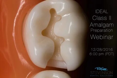 Class II Amalgam Preparation - Aired on December 28, 2016 6-8 pm PDT.