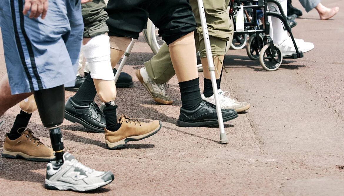Протезирование инвалидам 1 группы. Обувь на протез для инвалида. Обувь для ампутированной стопы.