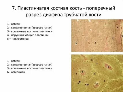 Поперечный срез костной ткани