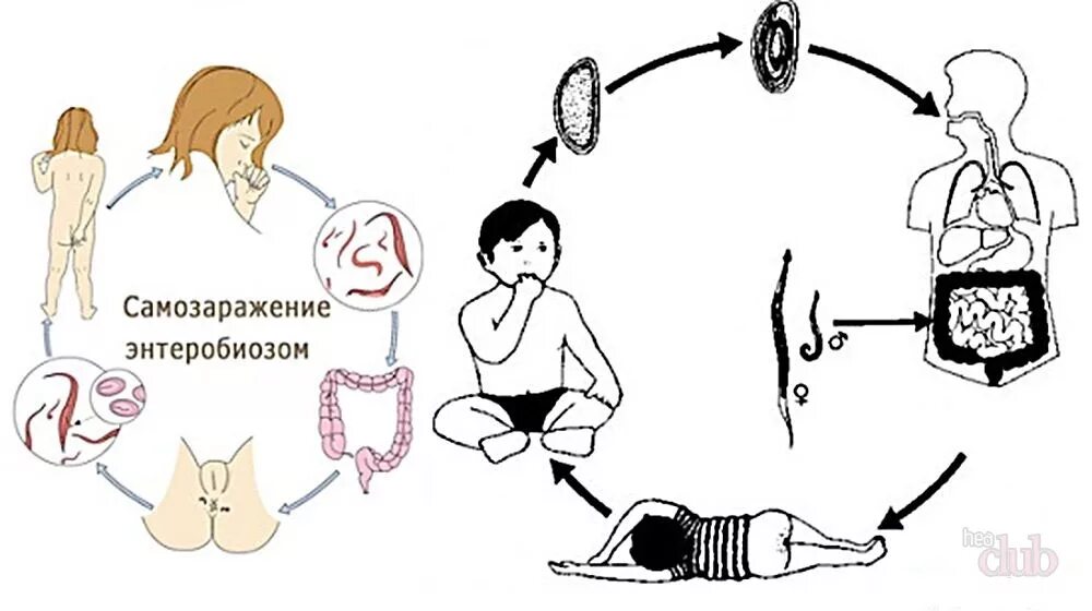 Жизненный цикл острицы детской схема. Схема заражения энтеробиозом. Схема заражения острицами. Энтеробиоз путь передачи заражение. Передача через слизистую