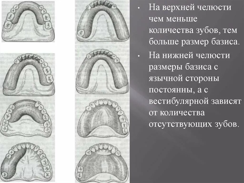 Зона податливости слизистой оболочки. Границы базиса съемного пластиночного протеза на нижнюю челюсть. Границы базиса на верхней челюсти. Границы металлического базиса беззубой нижней челюсти. Базис частичного съемного пластиночного протеза.