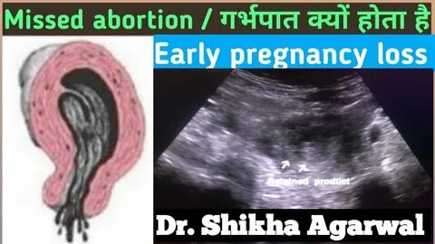 Erotik ayollar kurashi