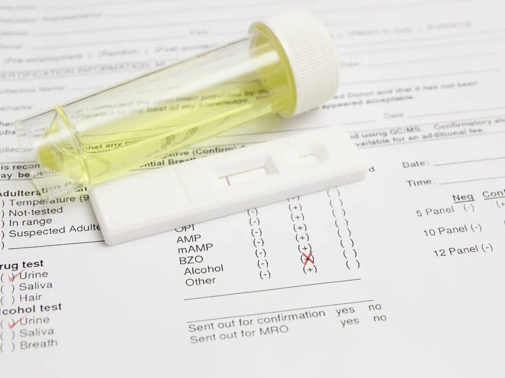 Гид тест. Dot urine drug Test form. Drug alcohol Test бланк. Common urine Test. Dot urine drug Test blank.