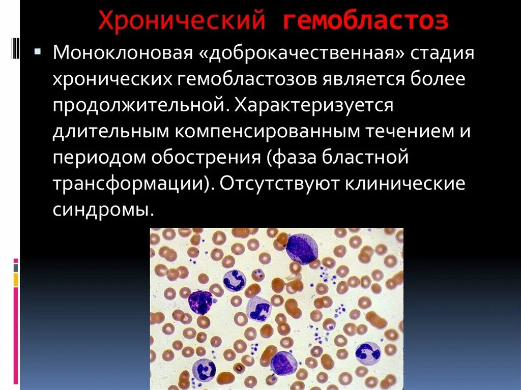 Первично-локальные гемобластозы. Гемобластозы. Гемобластозы патологическая анатомия. Хронические гемобластозы.