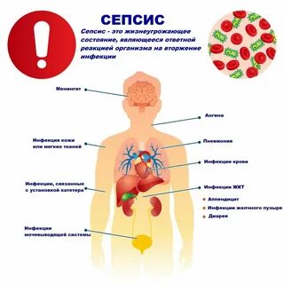 Могут ли инфекции пройти сами