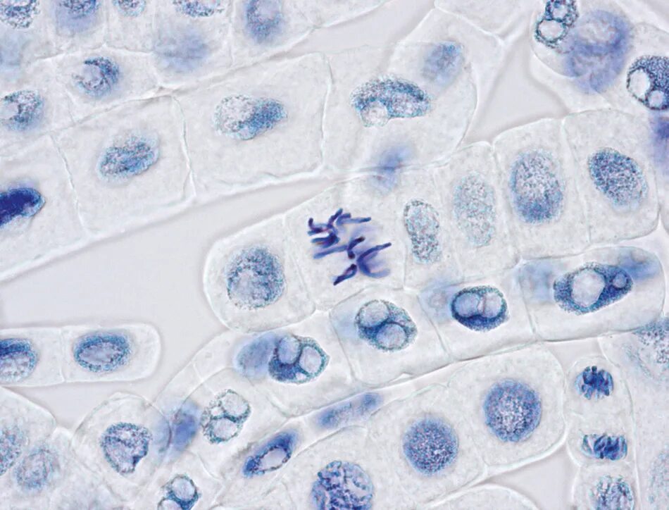Замороженные клетки. Замораживание клеток. Леток заморозка. Растительные клетки при замораживании.