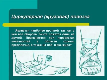 Циркулярная повязка