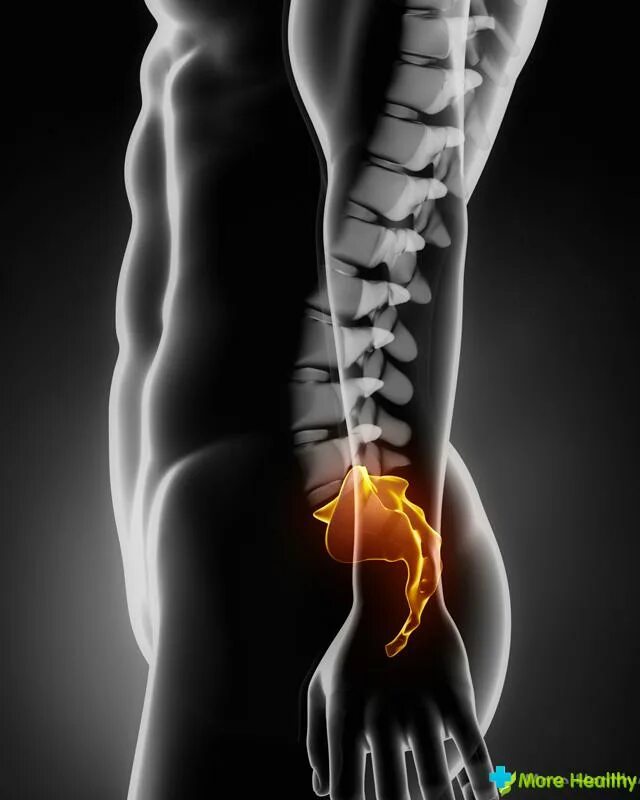 Боль в пояснице. Хвостовые позвонки копчик. Боль в крестцовой области. Лечение копчика поясницы. Лечение копчика поясницы.