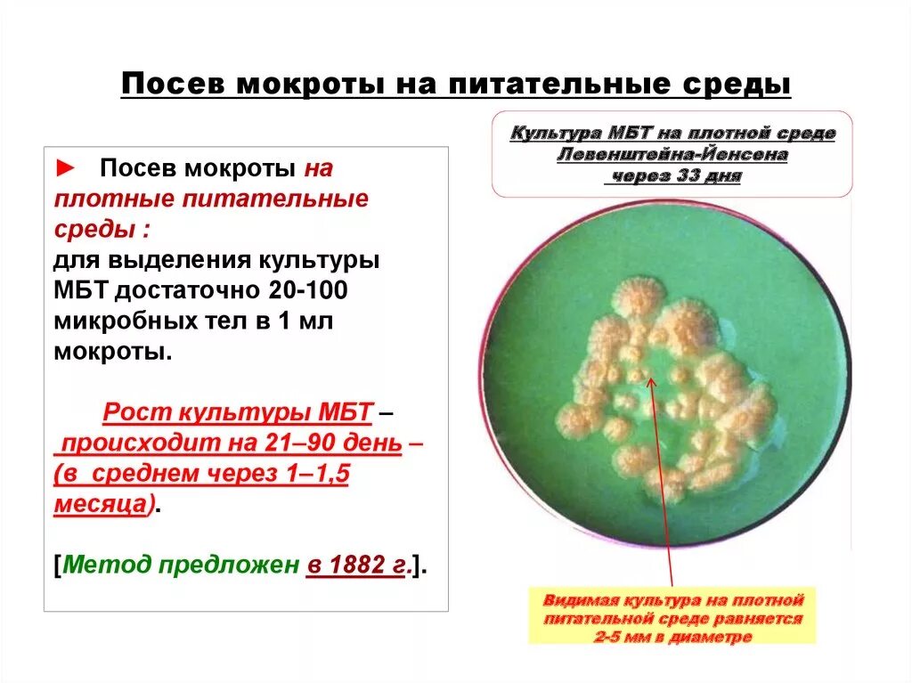 Мокрота в какую лабораторию. Питательные среды для микробиологического исследования мокроты. Диагностика туберкулеза посев мокроты. Посев мокроты на микобактерии туберкулеза. Возбудитель туберкулеза на питательной среде.