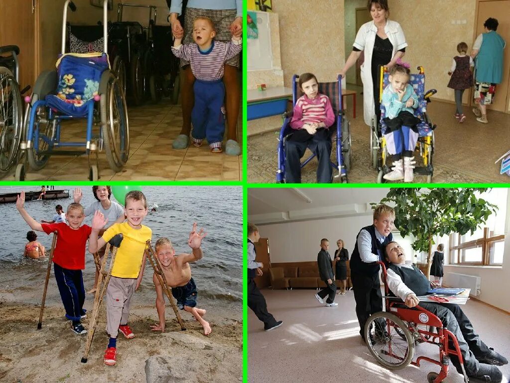Ребенок. Дети инвалиды. Дети инвалиды. Дети инвалиды. Люди с овз.