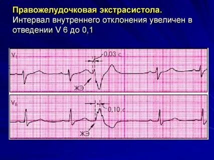 При отклонении не превышающем 1