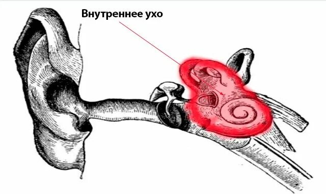 Воспалительные заболевания внутреннего уха (лабиринтиты).. Что такое лабиринтит внутреннего уха. Воспаление внутреннего уха лабиринтит. Травматический лабиринтит.