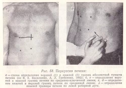 Пальпация и перкуссия печени по курлову. Перкуссия Нижнего края печени. Перкуссия печени нижняя граница. Перкуссия селезенки по курлову. Селезенка по курлову