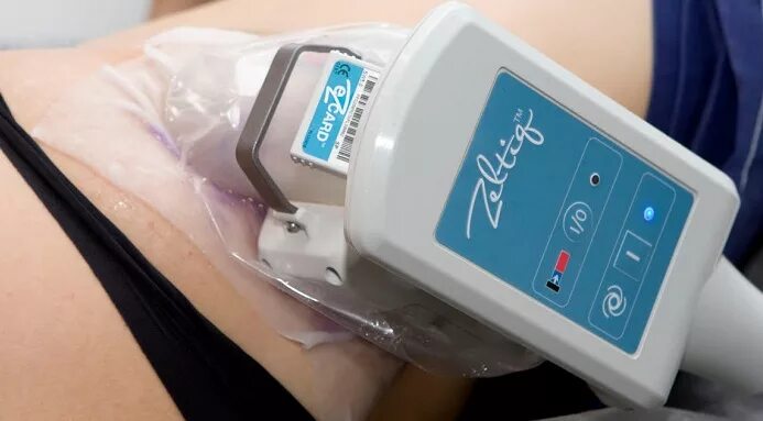 Cocoon аппарат криолиполиз. Cryolipolysis аппарат криолиполиз. Криолиполиз тела. Coolsculpting аппарат. Криолиполиз 360 аппарат.