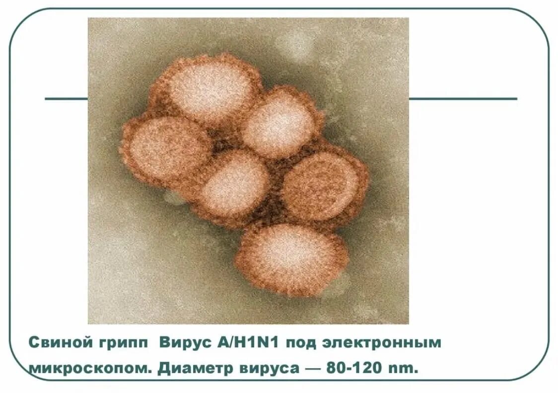 Возникновение гриппа. Свиной грипп. Вирус свиного гриппа. Свиной грипп возбудитель. Вирусы под микроскопом.