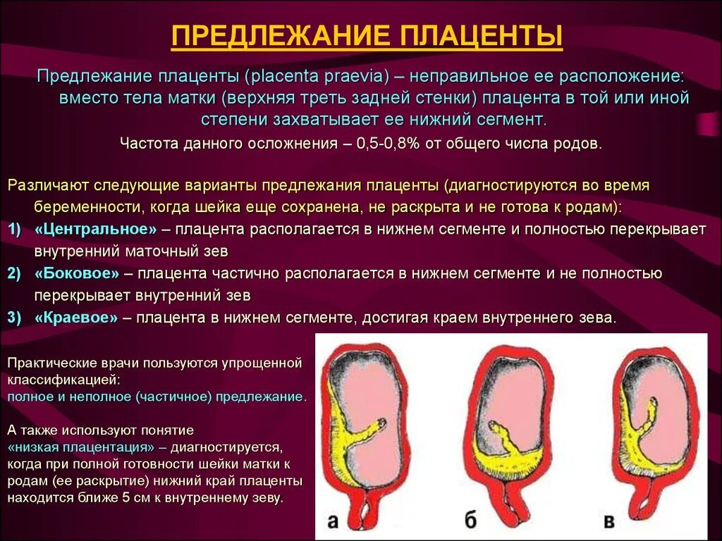 Плацента на какой неделе. Краевой синус плаценты перекрывает внутренний зев. Краевое предлежание плаценты 30 недель. Краевое предлежание плаценты доходит до внутреннего зева. Нижний край плаценты у внутреннего зева.