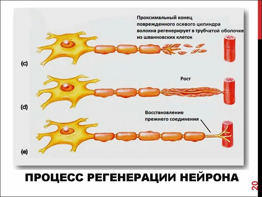 Регенерация миелиновых нервных волокон. Регенерация нервной ткани гистология. Схема регенерации нейрона после повреждения его отростка. Регенерация нервного волокна схема.